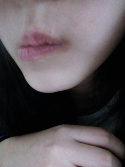 有些人确实形成黑圈了。